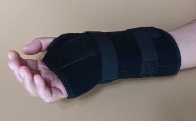 I fell and hurt my right hand
