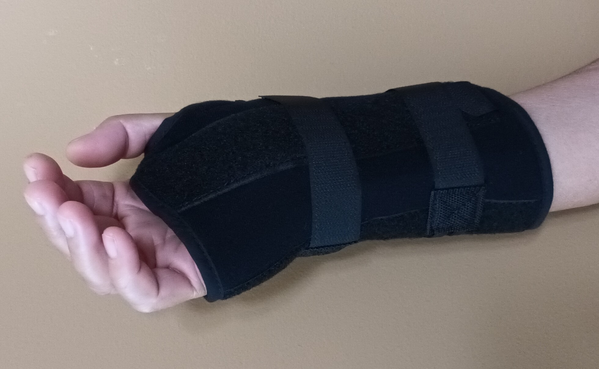 I fell and hurt my right hand